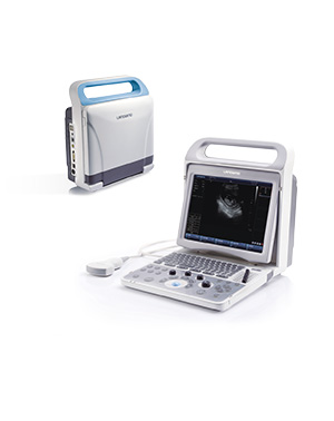 领先CU50全数字化超声诊断系统